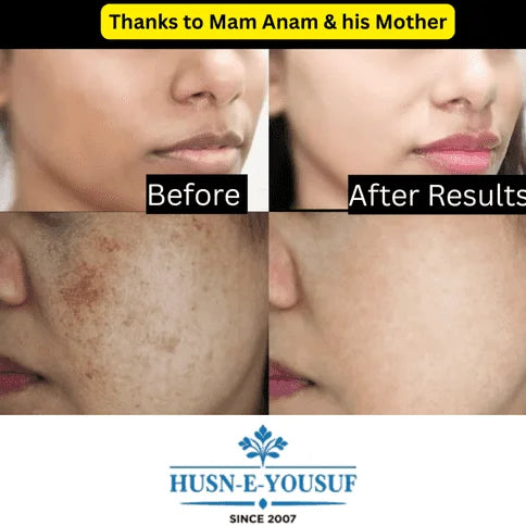 Husn-e-Yousuf Zafrani Whitening Cream