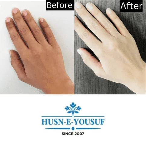 Husn-e-Yousuf Zafrani Whitening Cream
