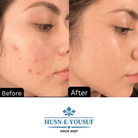 Husn-e-Yousuf Zafrani Whitening Cream