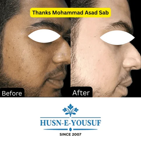 Husn-e-Yousuf Zafrani Whitening Cream